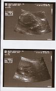 Scanned Photo-6
